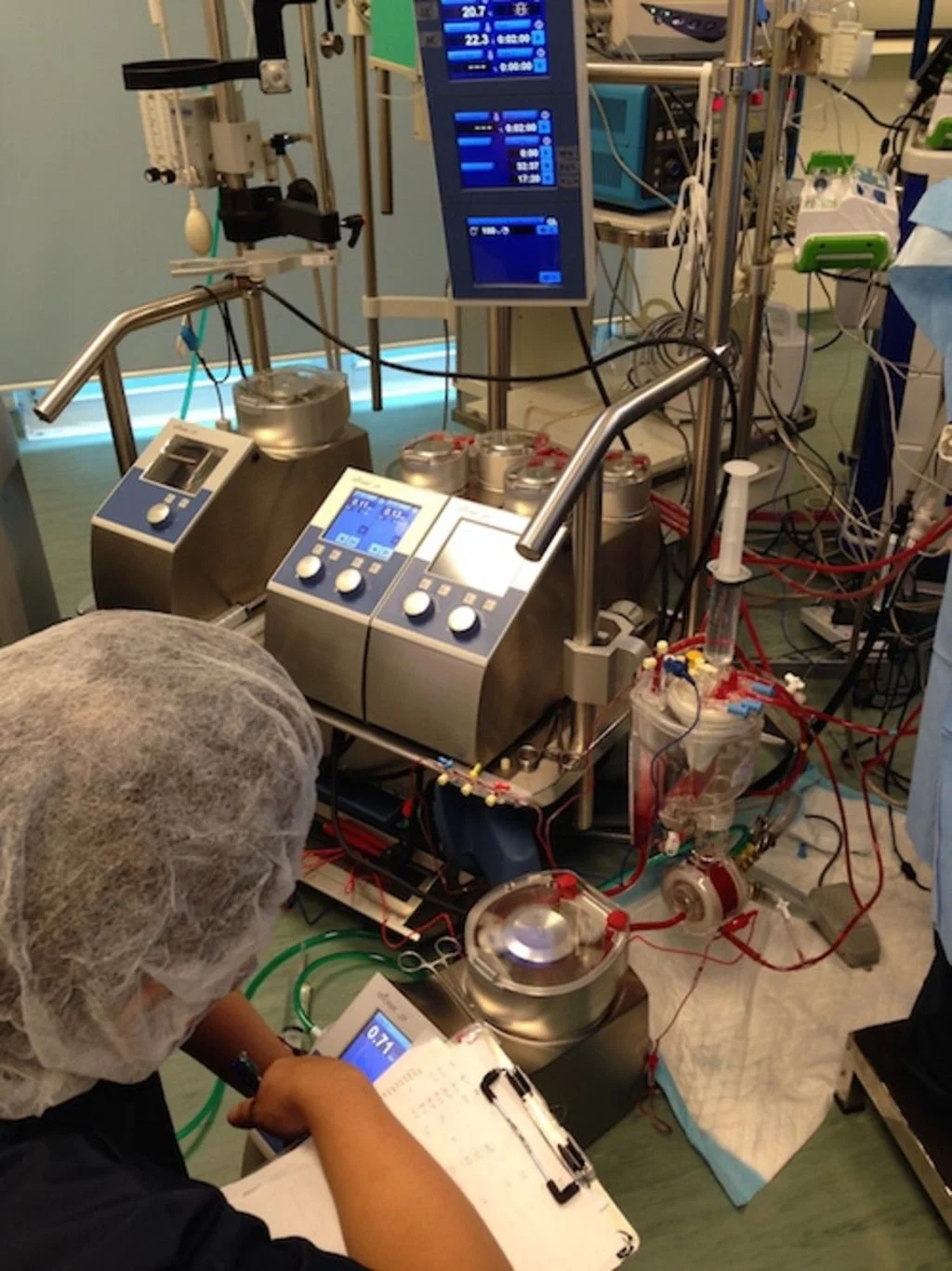 machine de circulation extracorporelle-1