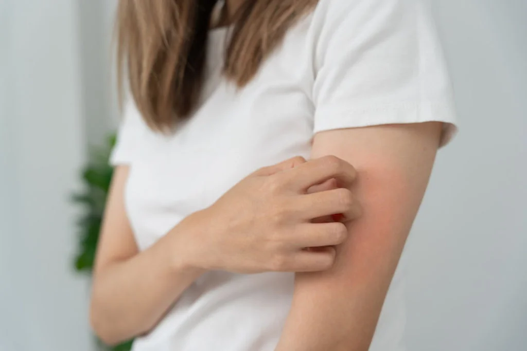 traitement symptomes allergie au chat